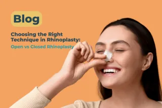 Open vs Closed Rhinoplasty: What the Science Says | Dr. Bülent Çığşar