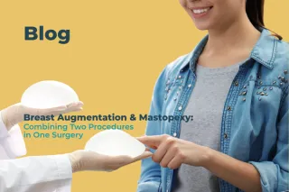Breast Augmentation & Mastopexy: Combined in One Surgery