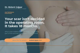 Your Scar Isn't Decided in the Operating Room. It's Decided Over the Next 18 Months.