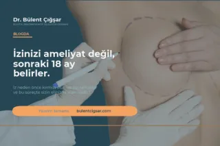 İzinizi Ameliyat Değil, Sonraki 18 Ay Belirler