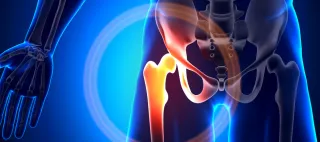 Is Your Lower Back Pain Really Coming From Your Hips?