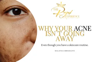 Why Your Acne Persists Despite Skincare Routine