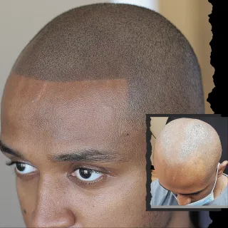 FAQ image