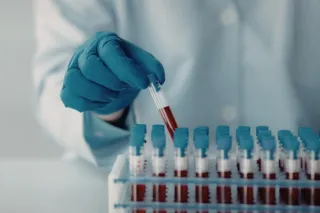 SpectraCell Micronutrient Testing: Hidden Deficiencies That Standard Labs Miss