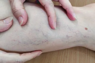 The Power of Ablation