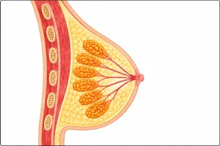 Breast Cancer