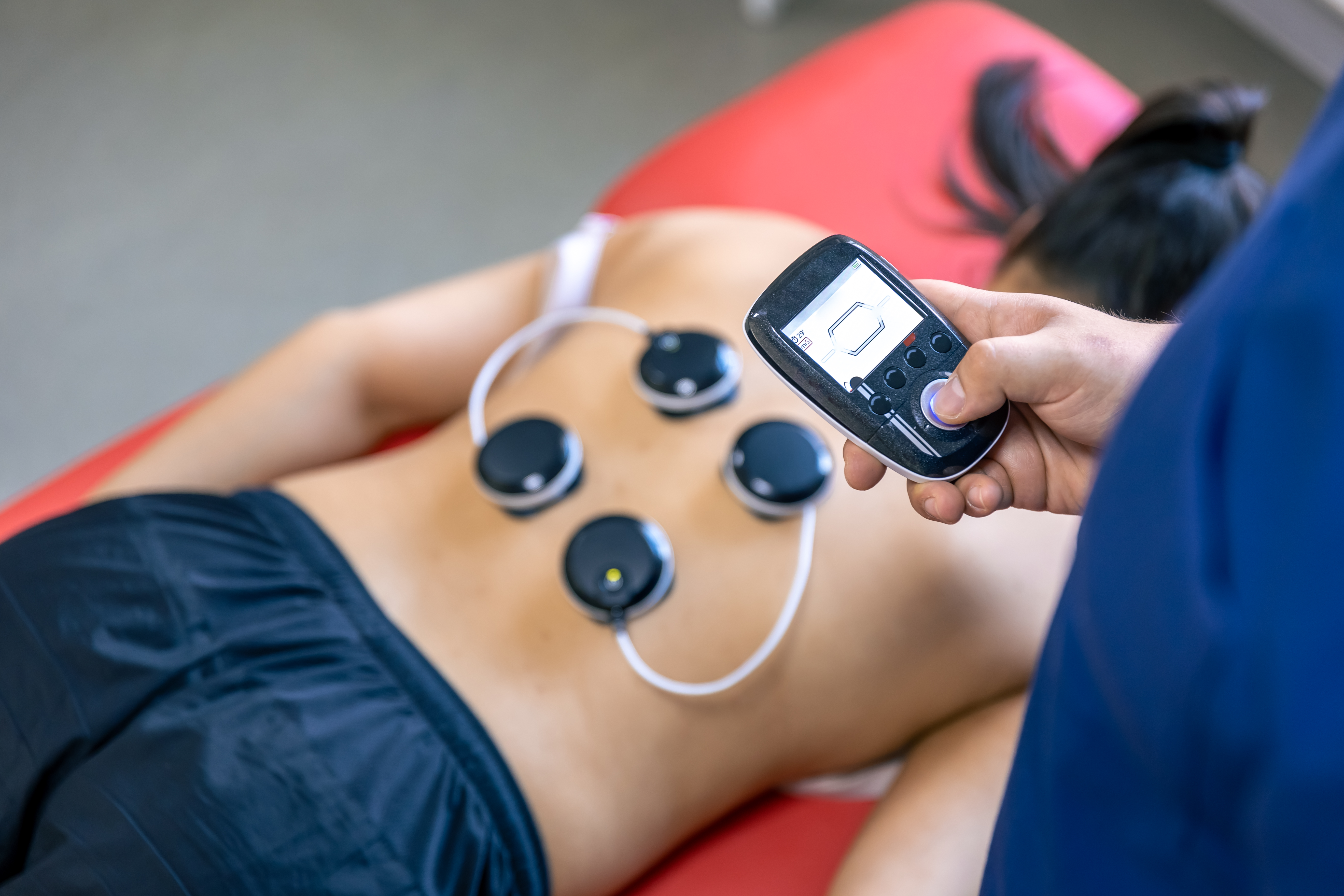 Interferential Stimulation Therapy
