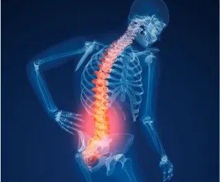 Let's Talk About Osteoporosis!!!