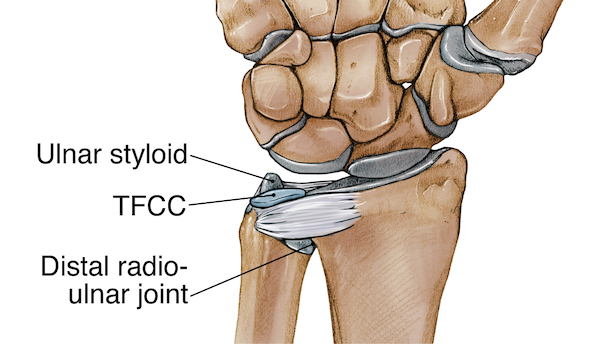 Triangular Fibrocartilage Complex