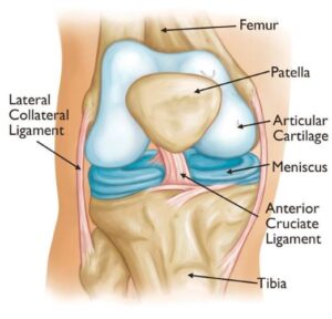 Knee Osteoarthritis