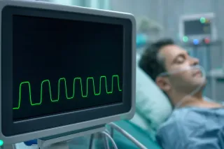 Capnography and Sedation Safety Statistics (2026): The Data on CO2 Monitoring