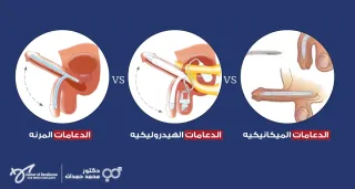أنواع دعامات القضيب وكيف تختار المناسب ليك – د. محمد حمدان