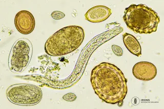 Could Parasites Be Causing Your Symptoms? Signs, Testing & What Most People Get Wrong