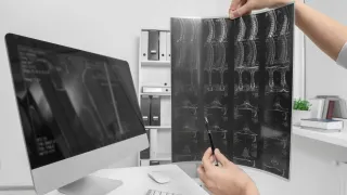 Non Invasive Spine Surgery Alternatives for Chronic Pain Plano TX: Achieving Relief Without Surgery: Effective Non Invasive Solutions