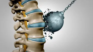 Cutting Edge Robotic Spine Surgery for Precision Treatment Plano TX: Advancing Precision in Spinal Care Through Robotic Surgery