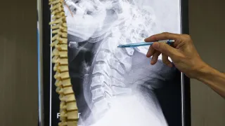 Spine Doctor Frisco TX: Comprehensive Spine Care and Diagnosis