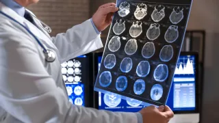 Orthopedic Spine Doctor Carrollton TX: Advanced Care with Minimally Invasive Neurosurgery of Texas
