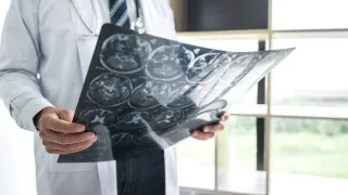 Highly Recommended Neck and Spine Neurosurgeon Plano TX: Restoring Comfort, Balance, and Confidence