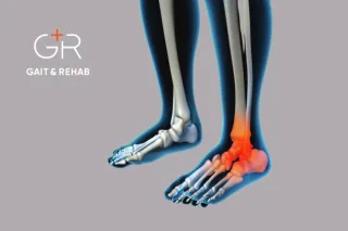 Ankle Osteoarthritis Treatment Guide: Expert Podiatry Solutions | Gait and Rehab