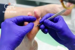Routine Podiatry Care in Knowle: Complete Foot Health Guide | Gait and Rehab