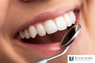 Same Day Teeth Whitening | Riverside Dental Stafford