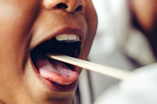 How Urgent Care Can Treat Strep Throat Fast