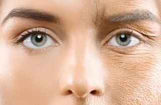 Anti-Aging Treatments That Really Work