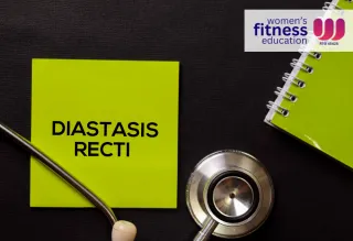 How to Fix Diastasis Recti Years Later