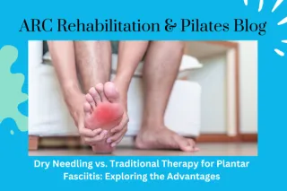 Dry Needling vs. Traditional Therapy for Plantar Fasciitis: Exploring the Advantages