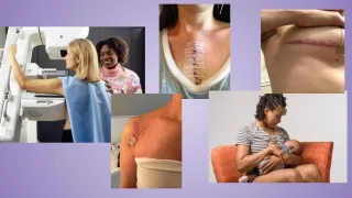 Support After Surgery Isn't One Size Fits All Post