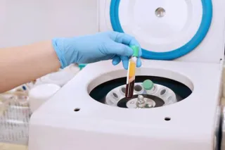 PRP Therapy for Joint Pain: A Non-Surgical Solution Expert Care by Dr. Brian Ellefsen in Sedalia, Missouri