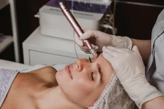 Why Central Coast Residents Are Choosing RF Microneedling for Age-Defying Skin