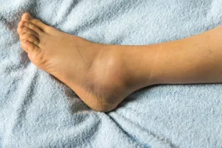Why Your Feet Ache Even at Rest—and What You Can Do About It