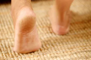 What Causes Cracked Heels—And How to Fix Them