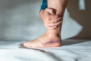 Swollen Ankles After Walking? Here's What Might Be Going On