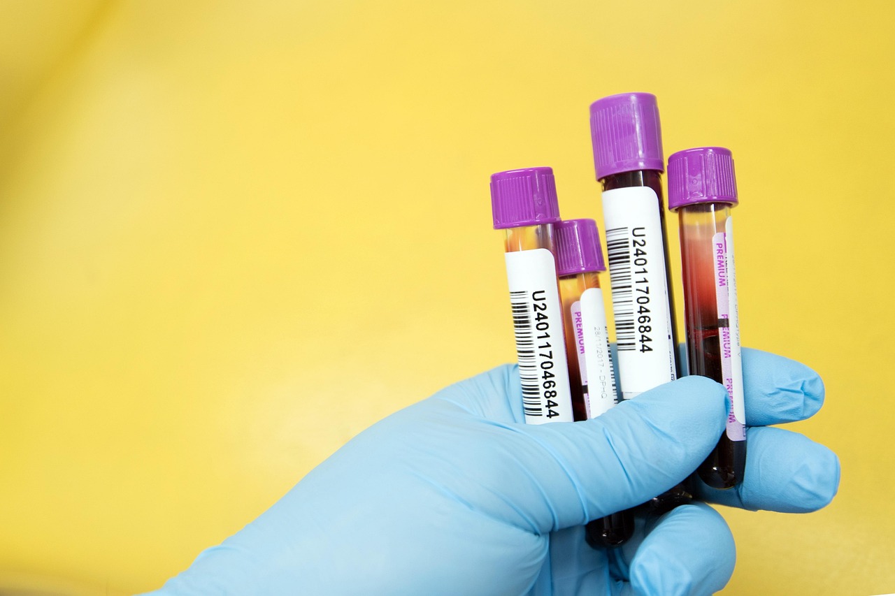 What Your Blood Tests Might Be Missing