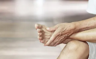 Hammer Toes