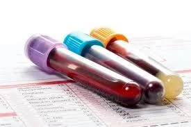 5 Common Misconceptions About Functional Medicine