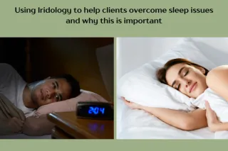 Sleep and iridology