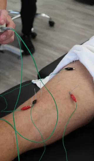 Maintaining Peak Performance: How Cupping, Dry Needling, and Myofascial Release Help Scottsdale and Peoria Residents Stay Pain-Free