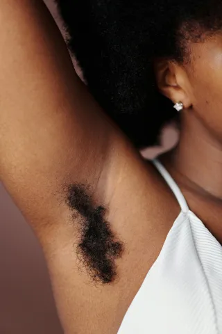 How Laser Hair Removal Works: A Step-by-Step Process Explained