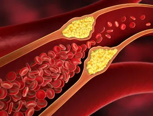 Visceral Fat & Weight Gain: What You Need to Know