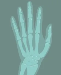 Bone and Muscle Health-What Nobody Told You