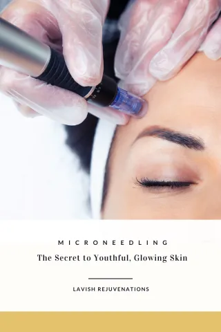Microneedling: The Secret to Youthful, Glowing Skin