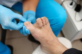 Expert Chiropodist Near Me: Your Guide to Foot Care in Dublin