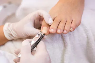 Expert Advice on Avoiding Ingrown Toenails: Best Practices for Healthy Nails