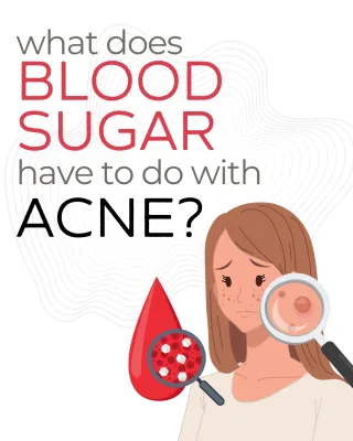 Tackling Acne by Balancing Blood Sugar and Hormones