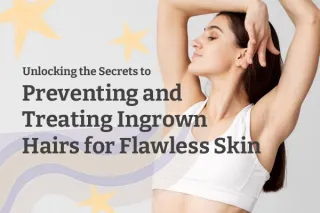 Unlocking the Secrets to Preventing and Treating Ingrown Hairs for Flawless Skin