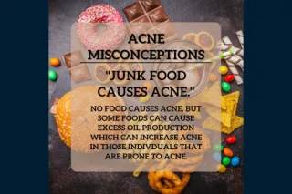 Acne Myths