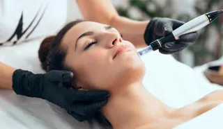 Best Microneedling Treatment Toronto: A Complete Guide to Skin Rejuvenation
